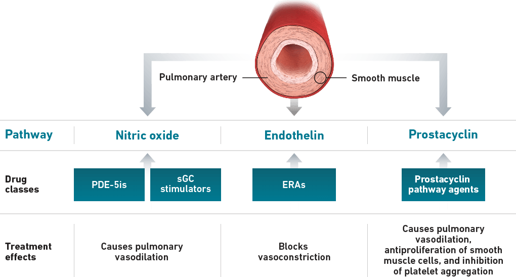 Pathways Diagram